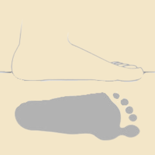 Flat Foot